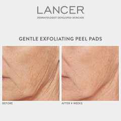Lancer Gentle Exfoliating Peel Pads  Нежные отшелушивающие подушечки для пилинга