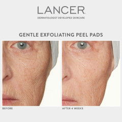Lancer Gentle Exfoliating Peel Pads  Нежные отшелушивающие подушечки для пилинга