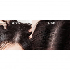 Rosinii Scalp Expert Lactic Acid + Urea Dry Scalp Soothing Treatment Scalp Expert Молочная кислота + мочевина Успокаивающее средство для сухой кожи головы